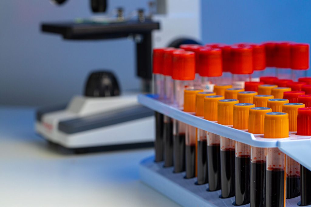 blood-test-tubes-in-lab-close-up